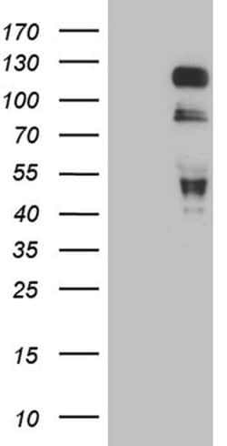MAPT Monoclonal Antibody (OTI6G3), TrueMAB , OriGene 100 &mu;L; Unconjugated:Antibodies,