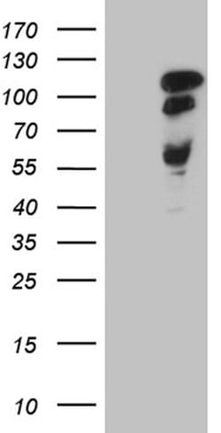MAPT Mouse anti-Human, Clone: OTI13B5, lyophilized, TrueMAB 100 &mu;g;