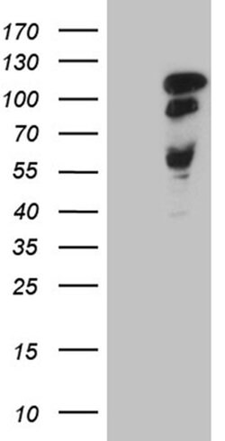 MAPT Monoclonal Antibody (OTI13B5), TrueMAB , OriGene 100 &mu;L; Unconjugated:Antibodies,