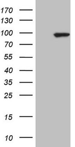 MARK3 Mouse anti-Human, Clone: OTI2D9, lyophilized, TrueMAB 100 &mu;g;