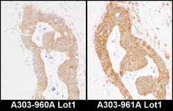 MARS Rabbit anti-Human, Mouse, Polyclonal, Bethyl Laboratories 100 &mu;L;