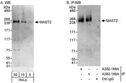 MAST2 Rabbit anti-Human, Polyclonal, Bethyl Laboratories 100 &mu;l; Unlabeled:Antibodies,