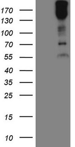 MAST2 Monoclonal Antibody (OTI2A3), TrueMAB , OriGene:Antibodies:Primary