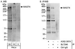MAST4 Rabbit anti-Human, Polyclonal, Bethyl Laboratories 100 &mu;L; Unconjugated:Antibodies,