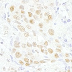 MAZ/SAF-1 Polyclonal Antibody, Bethyl Laboratories:Antibodies:Primary Antibodies
