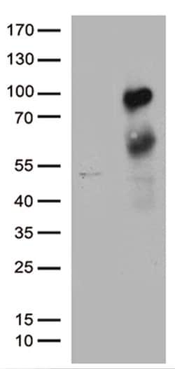 MBD1 Monoclonal Antibody (OTI1A1), TrueMAB , OriGene 100 &mu;L; Unconjugated:Antibodies,