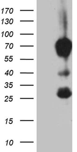 MBD1 Monoclonal Antibody (OTI2H5), TrueMAB , OriGene 100 &mu;L; Unconjugated:Antibodies,