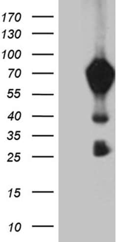MBD1 Monoclonal Antibody (OTI2D7), TrueMAB , OriGene 30 &mu;L | Buy Online | Origene Technologies | Fisher Scientific