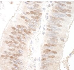 MBD3 Polyclonal Antibody, Bethyl Laboratories 10 &mu;L | Buy Online | Bethyl Laboratories, Inc | Fisher Scientific
