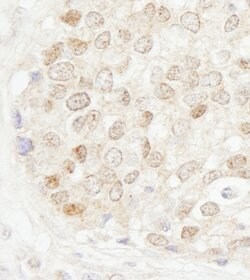 MBD4 Rabbit anti-Human, Polyclonal, Bethyl Laboratories 100 &mu;l; Unlabeled:Antibodies,