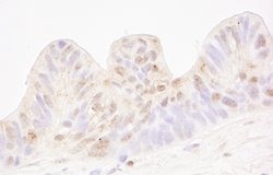 MBD4 Polyclonal Antibody, Bethyl Laboratories:Antibodies:Primary Antibodies