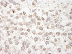 MBD4 Polyclonal Antibody, Bethyl Laboratories 100 &mu;L; Unconjugated:Antibodies,