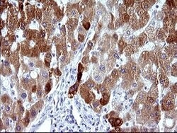 MBL2 Mouse anti-Human, Clone: OTI1A12, lyophilized, TrueMAB 100 &mu;g;