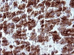 MBL2 Mouse anti-Human, Clone: OTI1A12, lyophilized, TrueMAB 100 &mu;g;