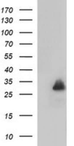 MBL2 Mouse anti-Human, Clone: OTI1A12, lyophilized, TrueMAB 100 &mu;g;