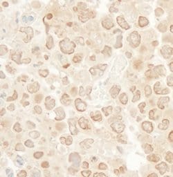 MCAK Rabbit anti-Mouse, Polyclonal, Bethyl Laboratories 100 &mu;L; Unconjugated:Antibodies,
