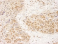 MCAK Polyclonal Antibody, Bethyl Laboratories:Antibodies:Primary Antibodies