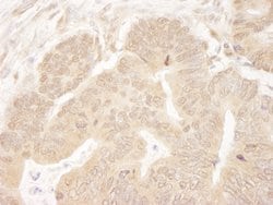 MCAK Polyclonal Antibody, Bethyl Laboratories 10 &mu;L; Unconjugated:Antibodies,
