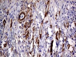 MCAM Mouse anti-Human, Clone: OTI2G10, lyophilized, TrueMAB 100 &mu;g | Buy Online | Origene Technologies | Fisher Scientific