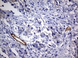 MCAM Monoclonal Antibody (OTI2B2), TrueMAB , OriGene 100 &mu;L; Unconjugated:Antibodies,