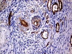 MCAM Monoclonal Antibody (OTI5C4), TrueMAB , OriGene 100 &mu;L; Unconjugated:Antibodies,
