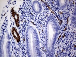 MCAM Monoclonal Antibody (OTI5C4), TrueMAB , OriGene 100 &mu;L; Unconjugated:Antibodies,