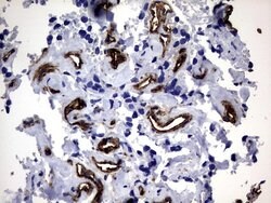 MCAM Monoclonal Antibody (OTI5C4), TrueMAB , OriGene 100 &mu;L; Unconjugated:Antibodies,