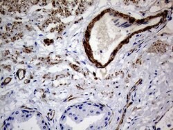 MCAM Mouse anti-Human, Clone: OTI5C4, lyophilized, TrueMAB 100 &mu;g; Unconjugated:Antibodies,