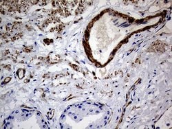 MCAM Monoclonal Antibody (OTI5C4), TrueMAB , OriGene 100 &mu;L; Unconjugated:Antibodies,