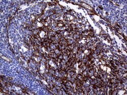MCAM Mouse anti-Human, Clone: OTI5C4, lyophilized, TrueMAB 100 &mu;g; Unconjugated:Antibodies,