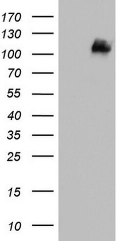 MCAM Monoclonal Antibody (OTI2B2), TrueMAB , OriGene:Antibodies:Primary