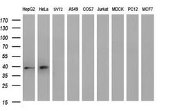 MCAT Mouse anti-Human, Clone: OTI2G1, lyophilized, TrueMAB 100 &mu;g; Unconjugated:Antibodies,