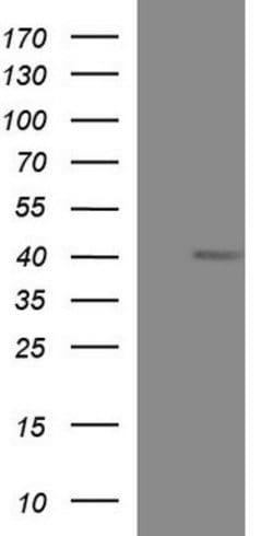 MCAT Monoclonal Antibody (OTI2H4), TrueMAB , OriGene:Antibodies:Primary