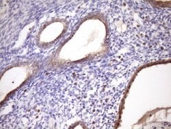 MCEE Monoclonal Antibody (OTI1B5), TrueMAB , OriGene 100 &mu;L; Unconjugated:Antibodies,