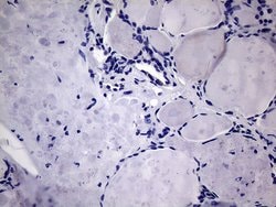 MCEE Monoclonal Antibody (OTI3B11), TrueMAB , OriGene 100 &mu;L; Unconjugated:Antibodies,