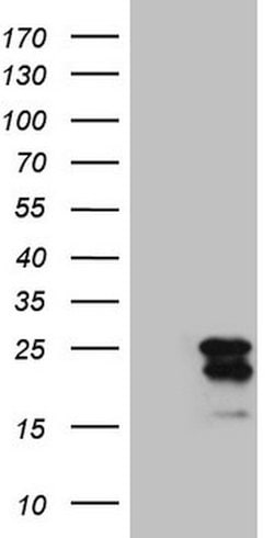 MCEE Mouse anti-Human, Clone: OTI9E12, lyophilized, TrueMAB 100 &mu;g;
