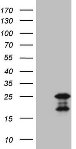 MCEE Mouse anti-Human, Clone: OTI4A6, lyophilized, TrueMAB 100 &mu;g; Unconjugated:Antibodies,