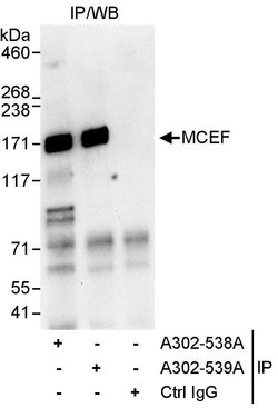 MCEF Rabbit anti-Human, Polyclonal, Bethyl Laboratories 100 &mu;L; Unconjugated:Antibodies,