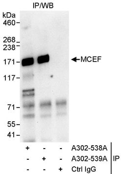 MCEF Rabbit anti-Human, Polyclonal, Bethyl Laboratories 10 &mu;L; Unconjugated:Antibodies,