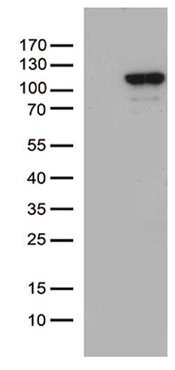 MCF2 Mouse anti-Human, Clone: OTI2C12, lyophilized, TrueMAB 100 &mu;g | Buy Online | OriGene | Fisher Scientific