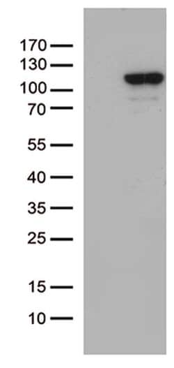 MCF2 Monoclonal Antibody (OTI2C12), TrueMAB , OriGene 30 &mu;L; Unconjugated:Anticuerpos