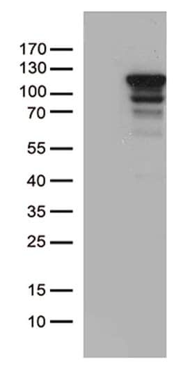 MCF2 Mouse anti-Human, Clone: OTI3E4, lyophilized, TrueMAB 100 &mu;g; Unconjugated:Antibodies,