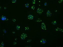 MCL1 Monoclonal Antibody (OTI2D6), TrueMAB , OriGene 100 &mu;L | Buy Online | Origene Technologies | Fisher Scientific