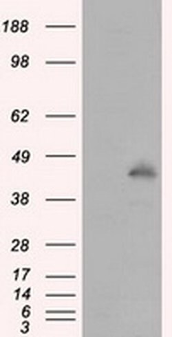 MCL1 Monoclonal Antibody (OTI2D6), TrueMAB , OriGene 100 &mu;L | Buy Online | Origene Technologies | Fisher Scientific