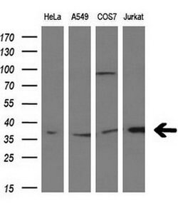MCL1 Mouse anti-Human, Clone: OTI2E11, liquid, TrueMAB 30 &mu;L | Buy Online | Origene Technologies | Fisher Scientific
