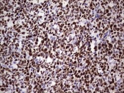 MCM2 Monoclonal Antibody (OTI1H2), TrueMAB , OriGene:Antibodies:Primary