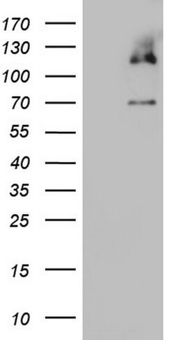 MCM2 Mouse anti-Human, Clone: OTI8A11, lyophilized, TrueMAB 100 &mu;g | Buy Online | Origene Technologies | Fisher Scientific