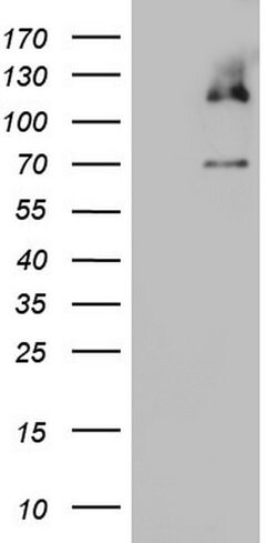 MCM2 Monoclonal Antibody (OTI8A11), TrueMAB , OriGene 100 &mu;L; Unconjugated:Antibodies,
