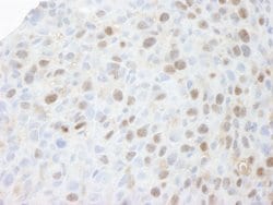 MCM3 Polyclonal Antibody, Bethyl Laboratories 100 &mu;L; Unconjugated:Antibodies,