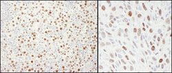 MCM4 Rabbit anti-Human, Mouse, Polyclonal, Bethyl Laboratories 100 &mu;L;